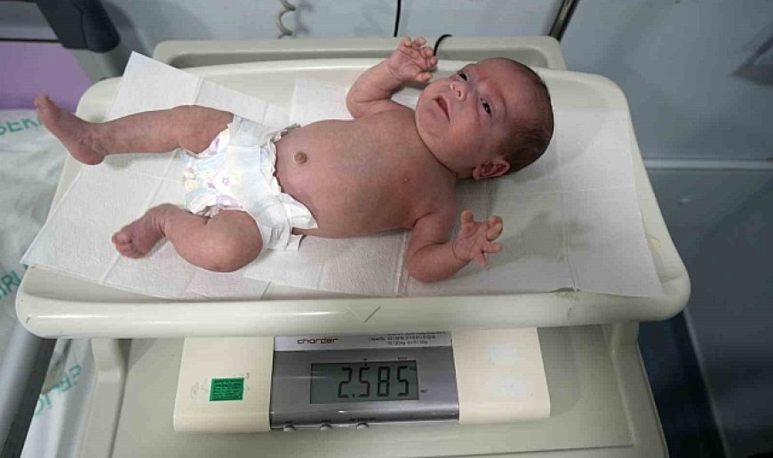 895 gram doğan Güneş bebek hayata tutundu